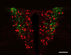 Investigan cómo afecta la ausencia de un gen relacionado con el síndrome de Rett en el desarrollo neuronal masculino