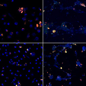 Investigadores de la UPV dan con una alternativa a la quimioterapia en el cáncer de próstata